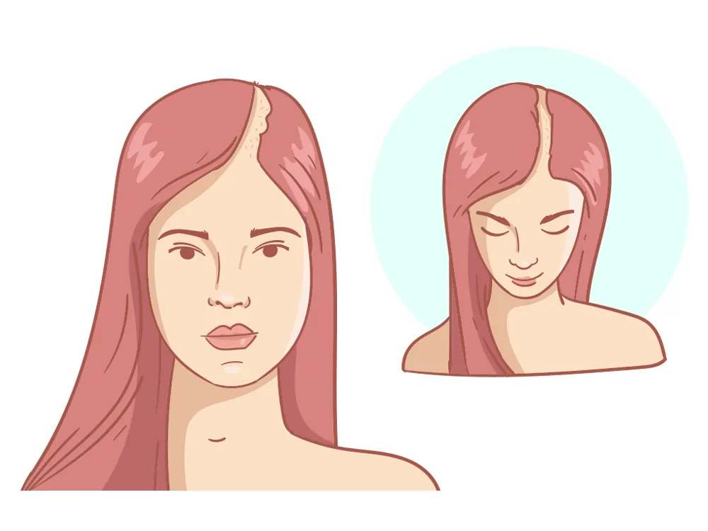 Rückläufige Haarlinie Strong + Crown